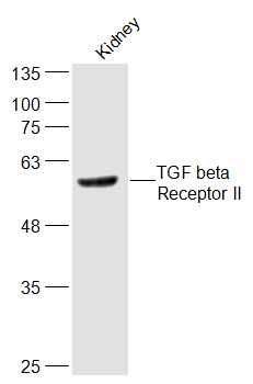 TGF beta Receptor II 转移生长因子β受体2抗体