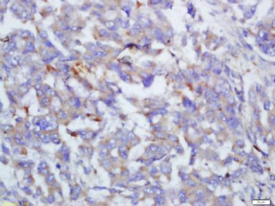 过敏毒素C4\/补体C4抗体图片,过敏毒素C4\/补体