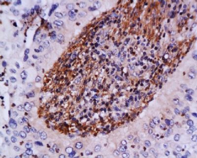 毛细血管扩张性共济失调症突变蛋白抗体-上海