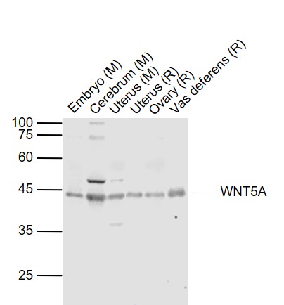 vas deferens, 40 ug lane 5: ovary (rat) lysate at 40 ug lane 6: vas deferens