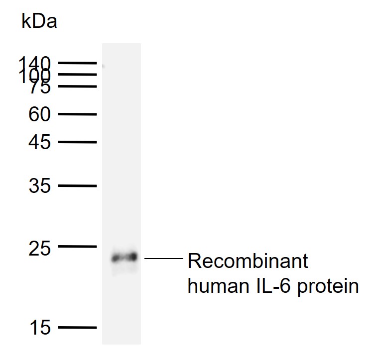 Primary AntiIL6 (bsm43079M) at 1/1000 dilution