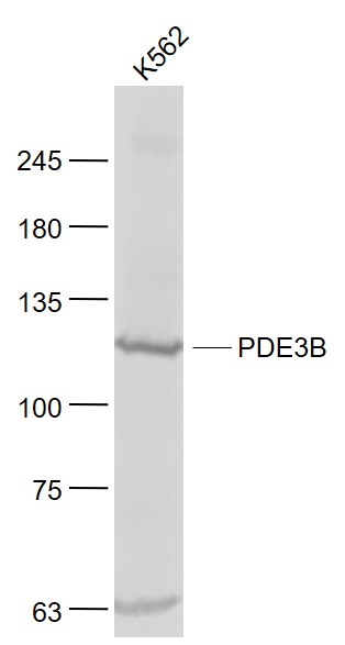 环核苷酸磷酸二酯酶PDE3B抗体-bs-8621R