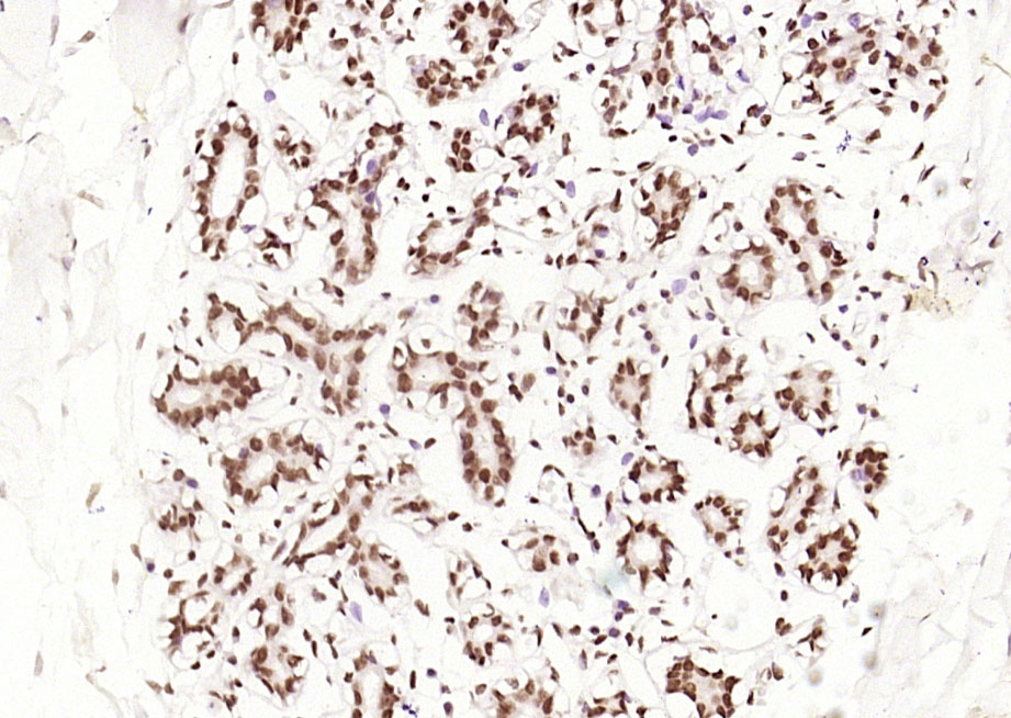 磷酸化雌激素受体ER alpha 重组兔单抗-bsm-52154R