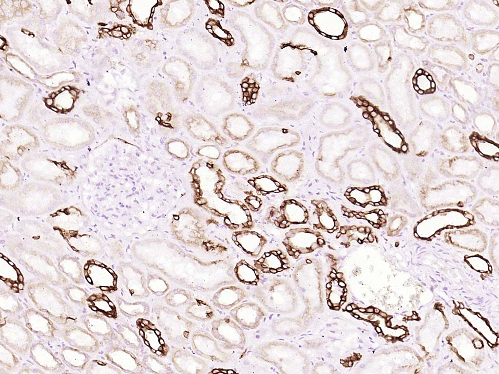 磷酸化糖原合酶激酶-3β重组兔单抗-bsm-52160R