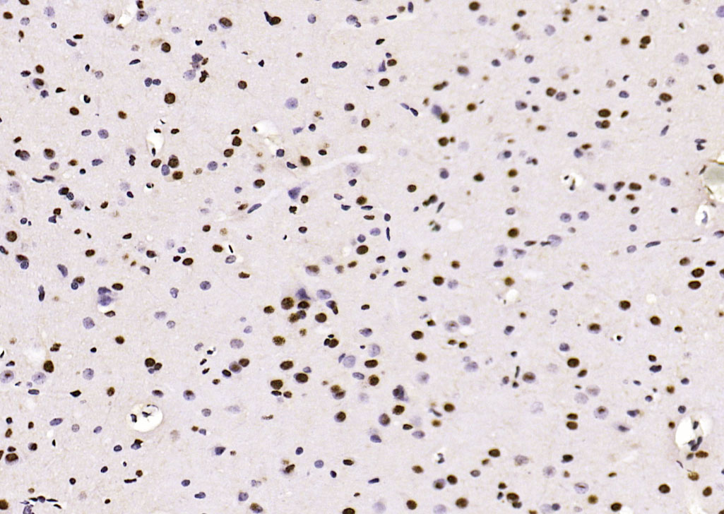 磷酸化肿瘤抑制基因PTEN抗体-bs-3351R