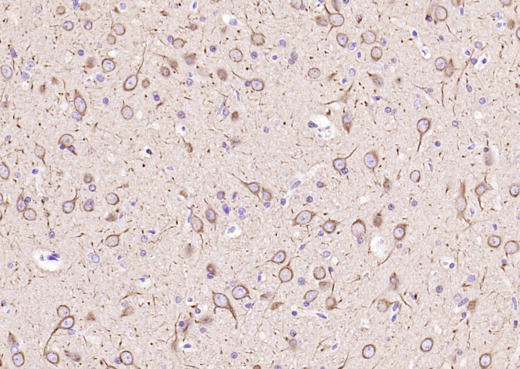 微管蛋白β tubulin/Tubulin β（内参）单克隆抗体-bsm-33034M