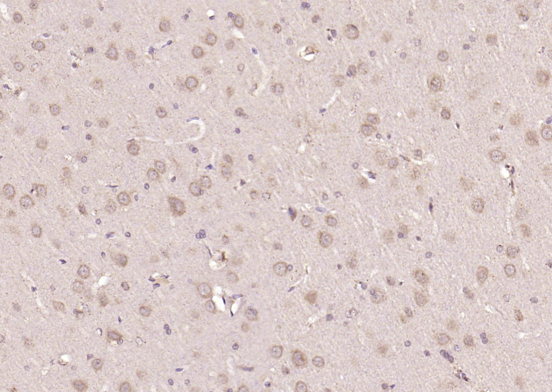 细胞信号转导分子Smad-2抗体-bs-0718R