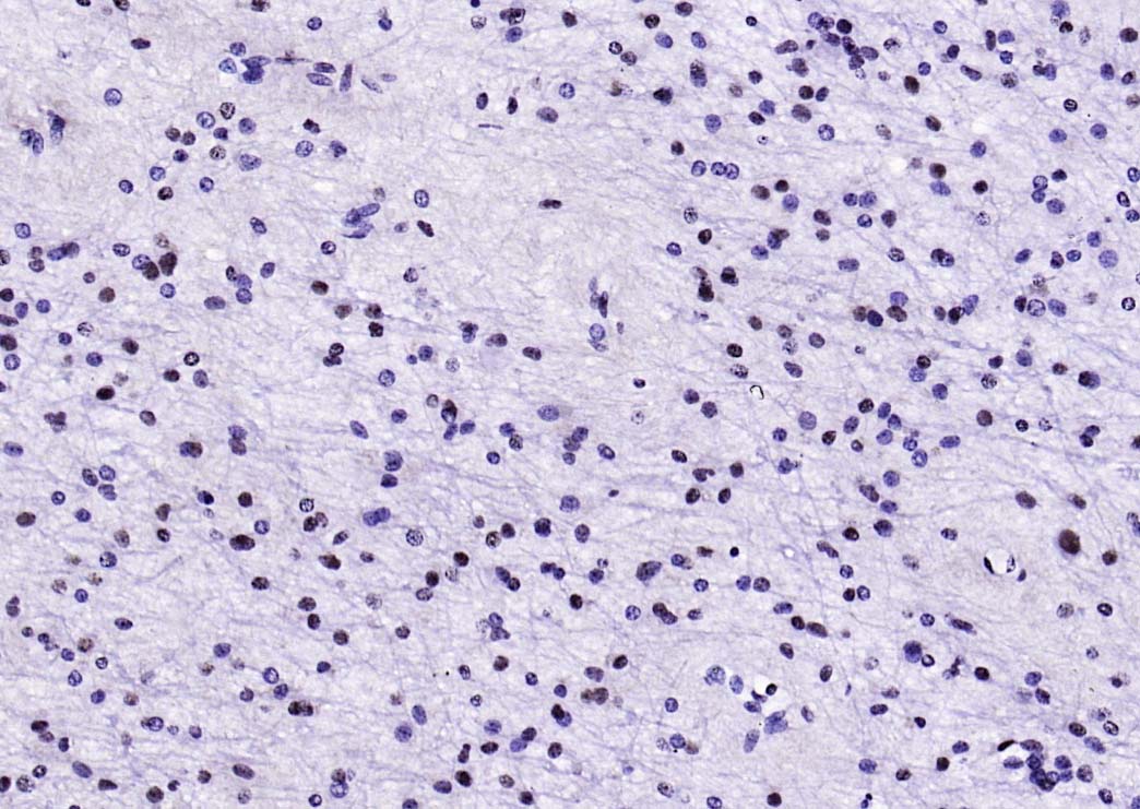 组蛋白去乙酰化酶2重组兔单抗-bsm-52082R