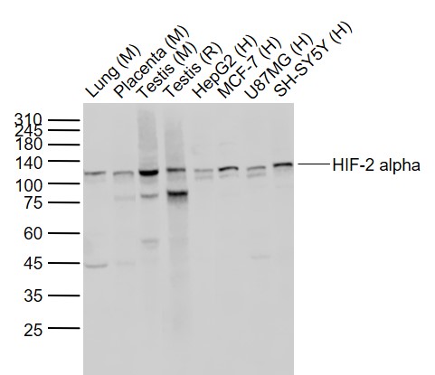 缺氧诱导因子2α/EPAS1重组兔单抗-bsm-54278R
