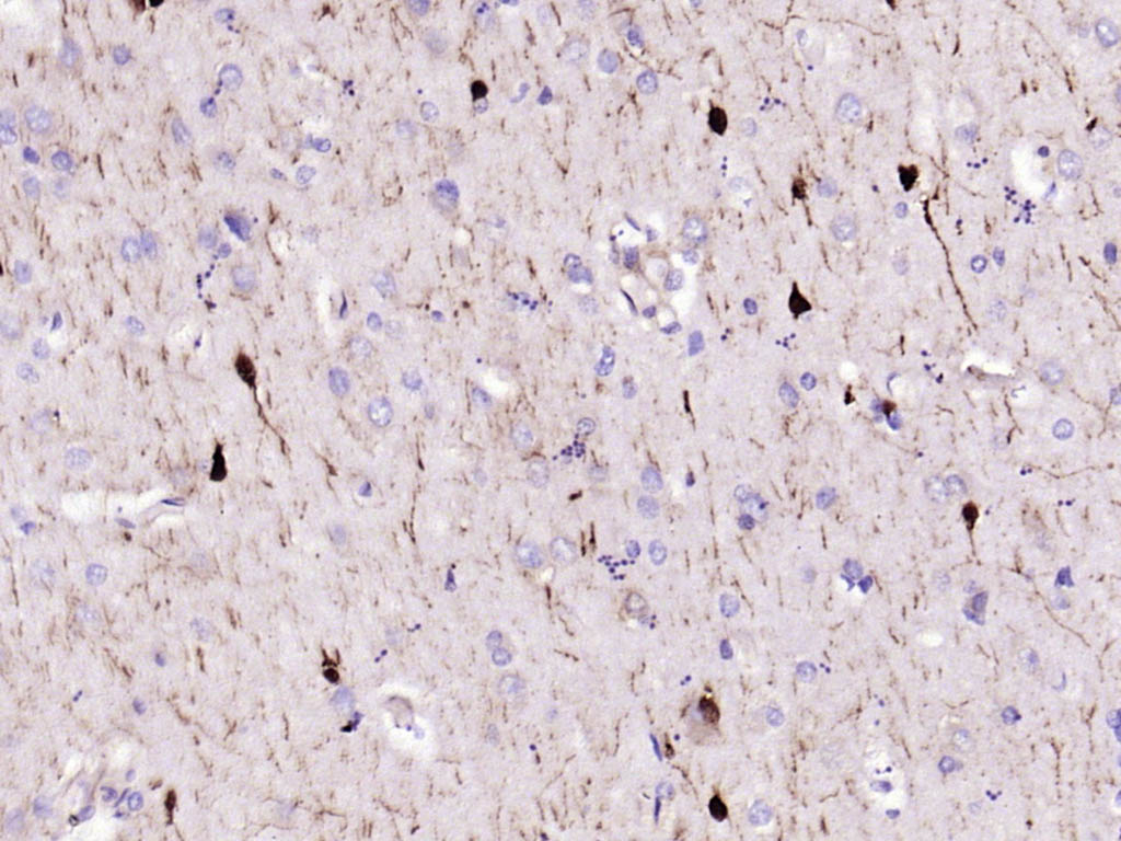钙结合蛋白重组兔单抗-bsm-54076R
