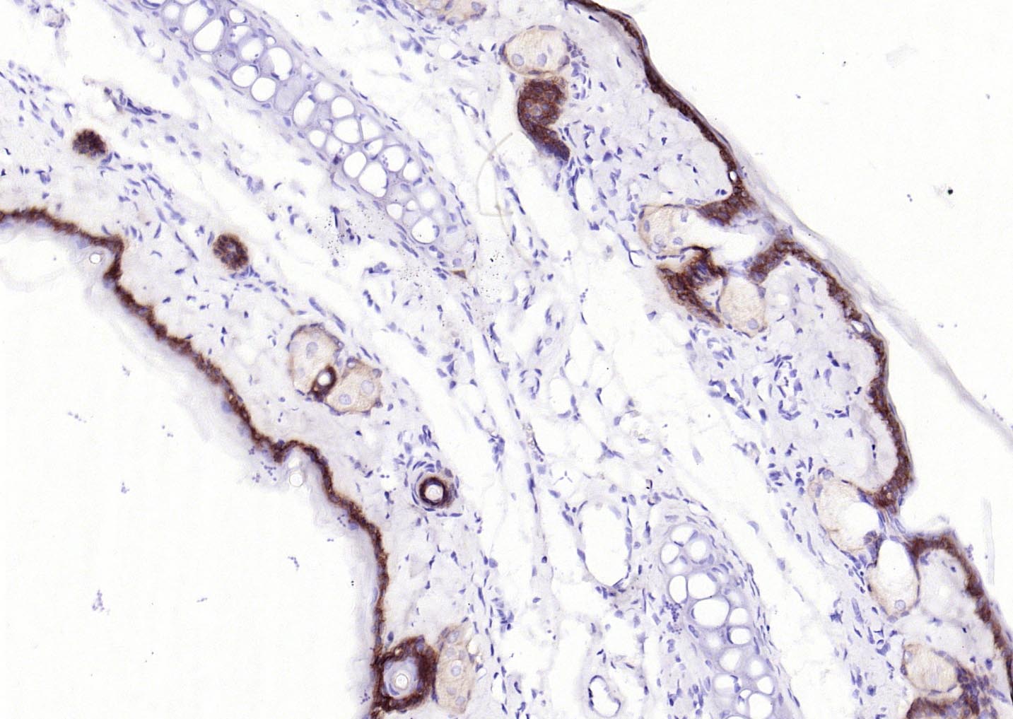 胶原蛋白17重组兔单抗-bsm-52041R