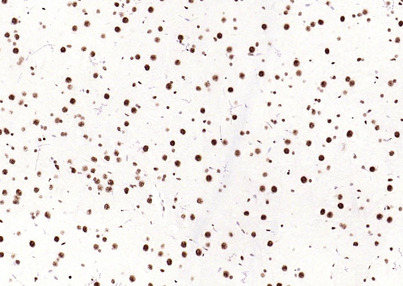 磷酸化细胞信号转导分子SMAD5重组兔单抗-bsm-52206R