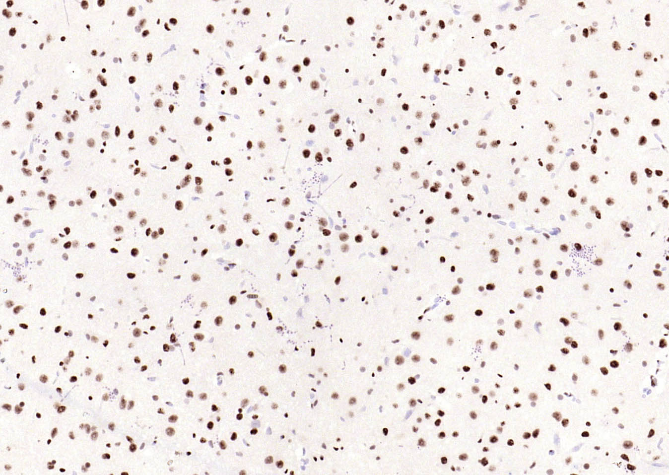 磷酸化细胞信号转导分子SMAD5重组兔单抗-bsm-52206R