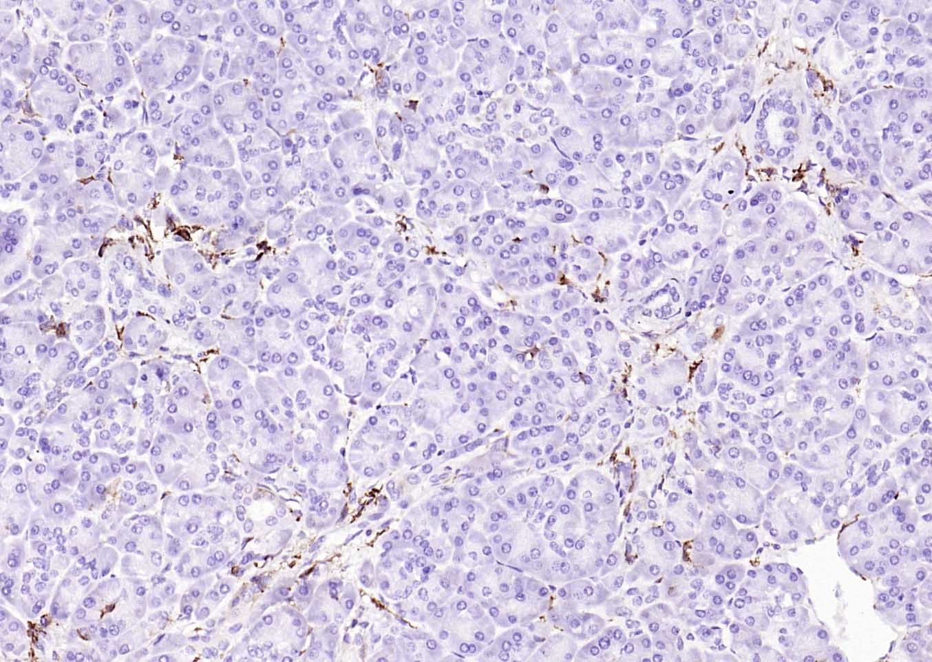 CD14重组兔单抗-bsm-52556R
