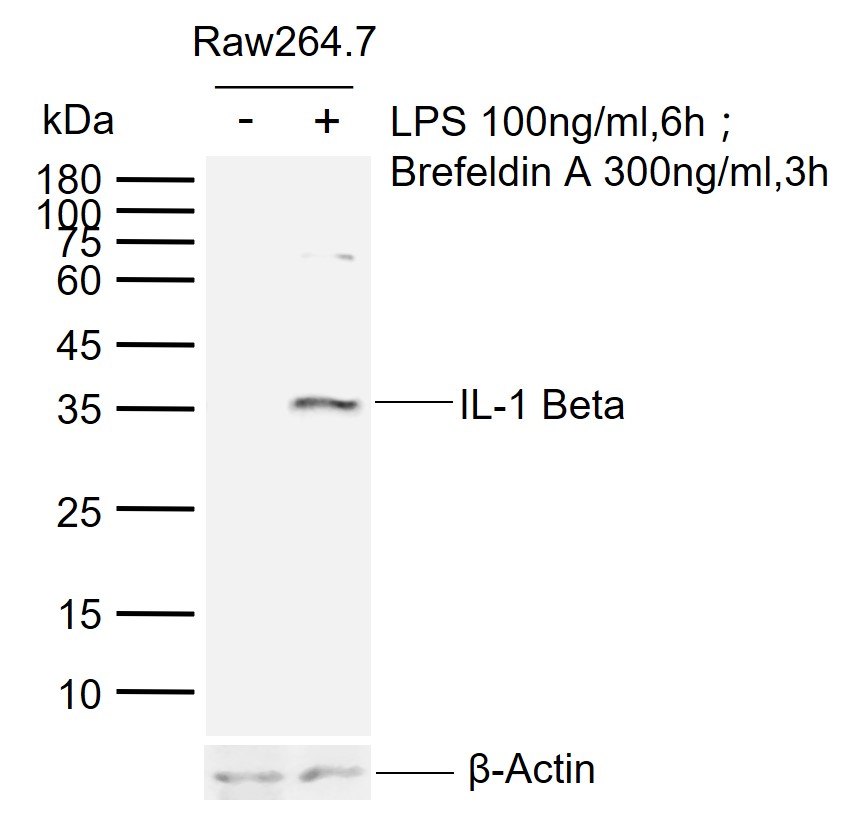 白介素1β/IL-1β抗体-bs-0812R