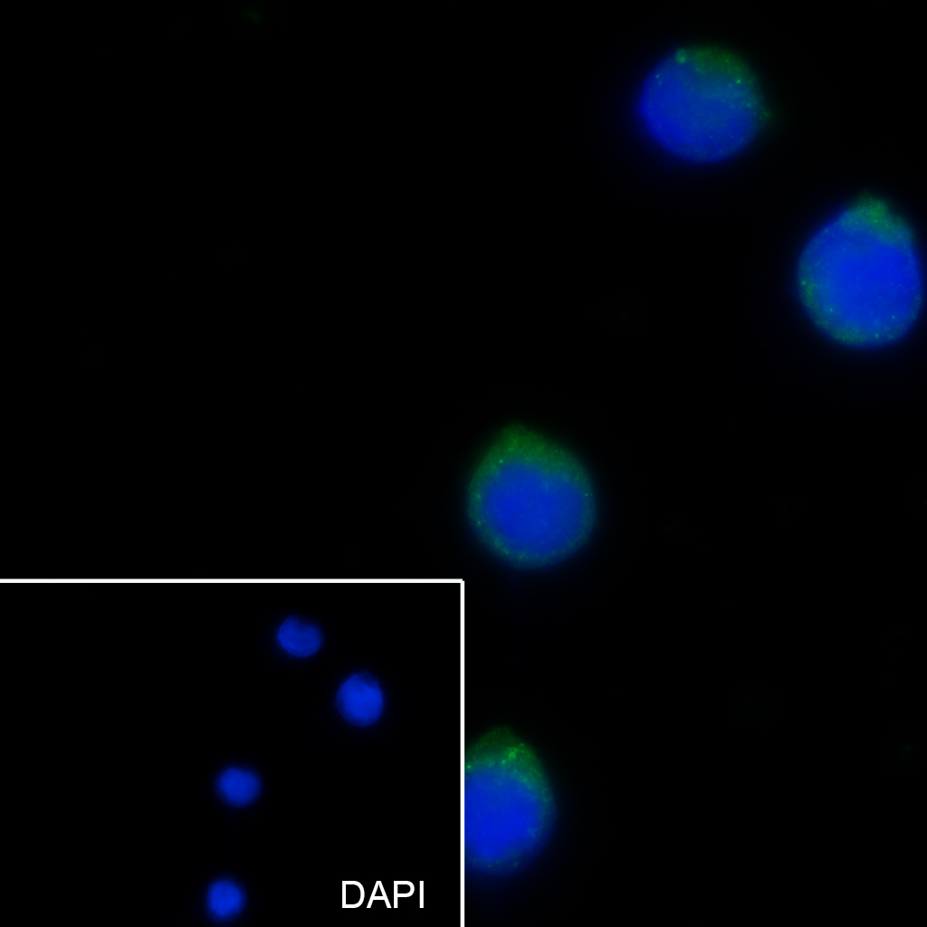 CD13重组兔单抗-bsm-60371R