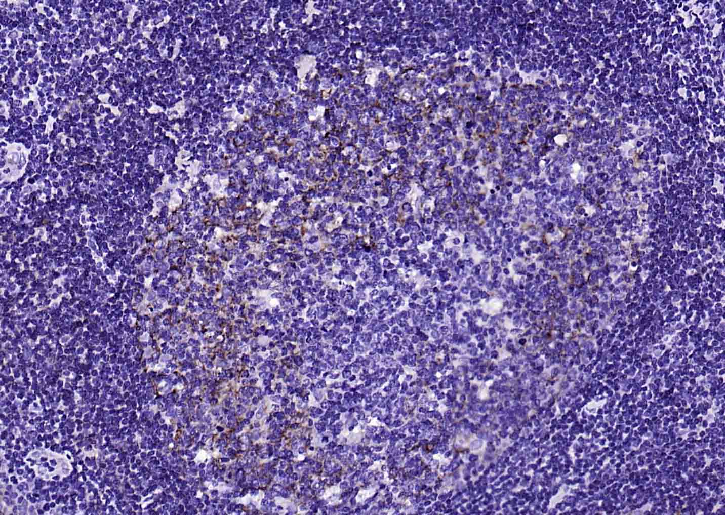 CD23重组兔单抗-bsm-60453R