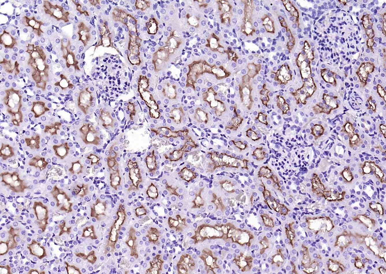 CD13重组兔单抗-bsm-60371R