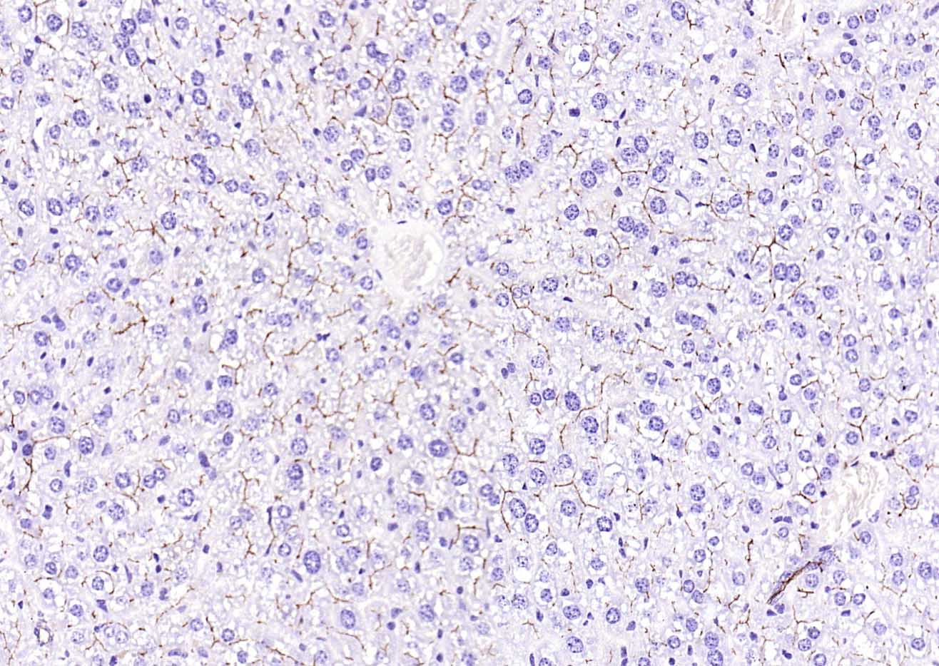 CD13重组兔单抗-bsm-60371R