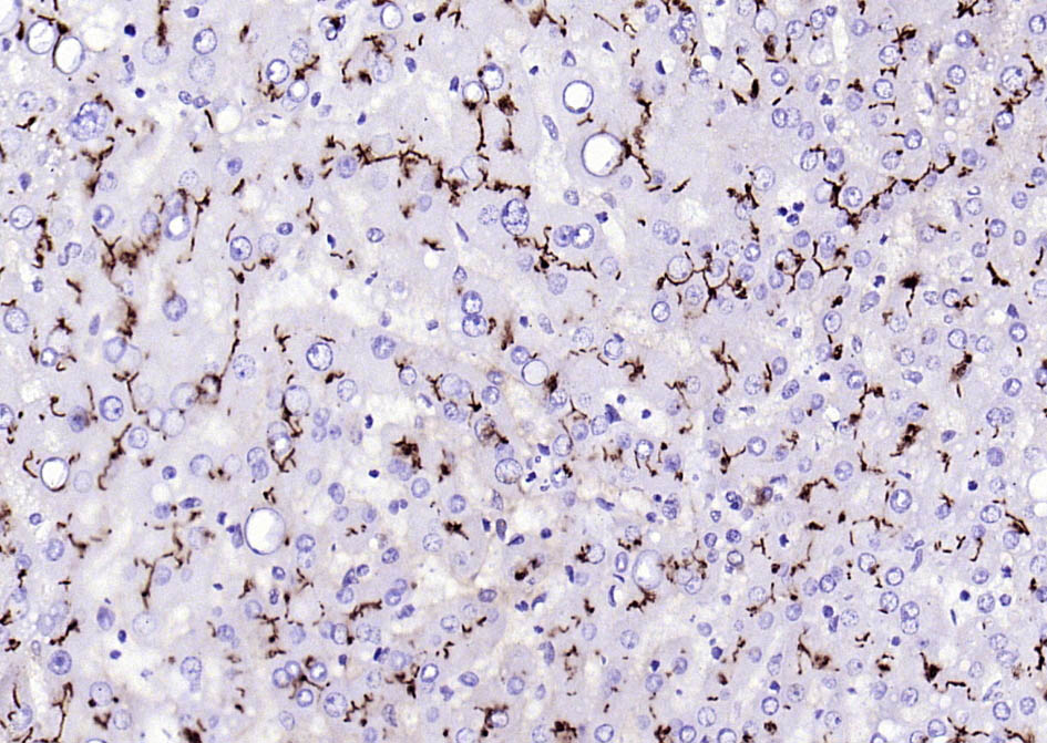 CD13重组兔单抗-bsm-60371R