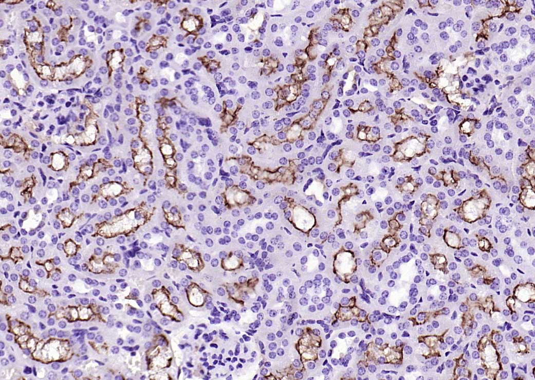CD13重组兔单抗-bsm-60371R