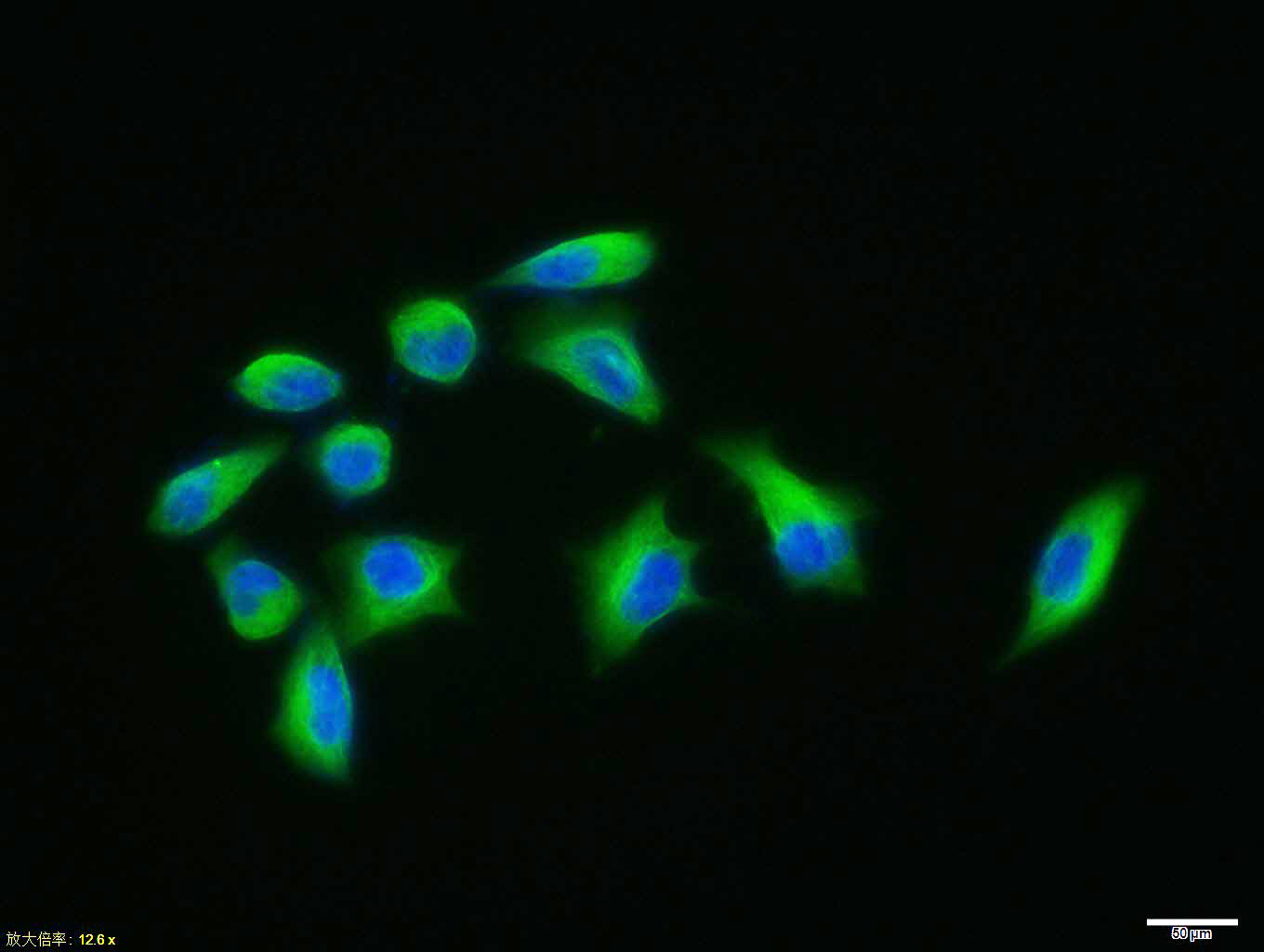 微管蛋白β tubulin/Tubulin β（内参）单克隆抗体-bsm-33034M