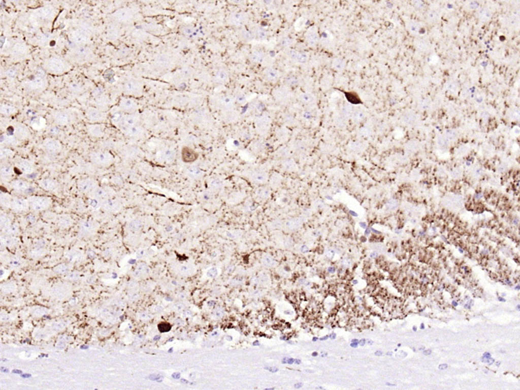 钙结合蛋白重组兔单抗-bsm-54076R