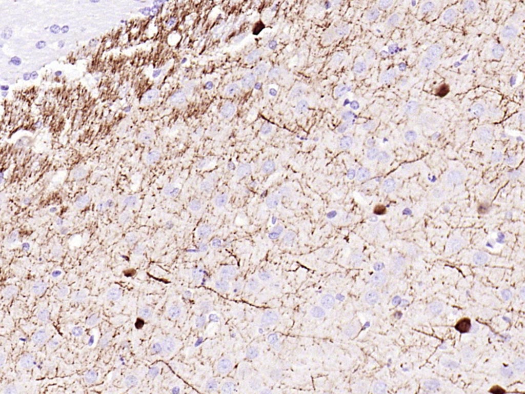 钙结合蛋白重组兔单抗-bsm-54076R