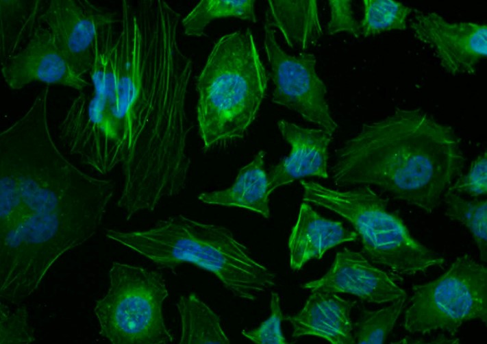 β-肌动蛋白/β-Actin（内参）抗体-bs-0061R