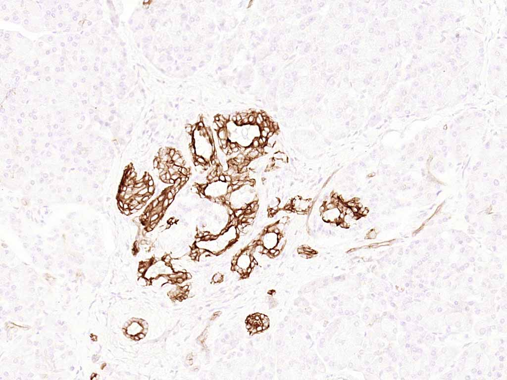 细胞角蛋白19重组兔单抗-bsm-52059R