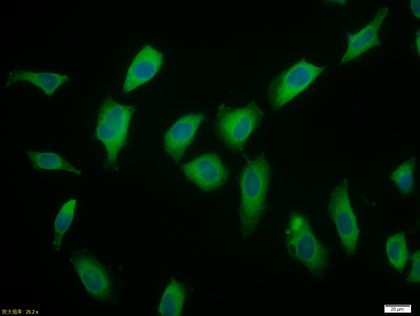 微管蛋白β tubulin(内参)单克隆抗体-bsm-33041M