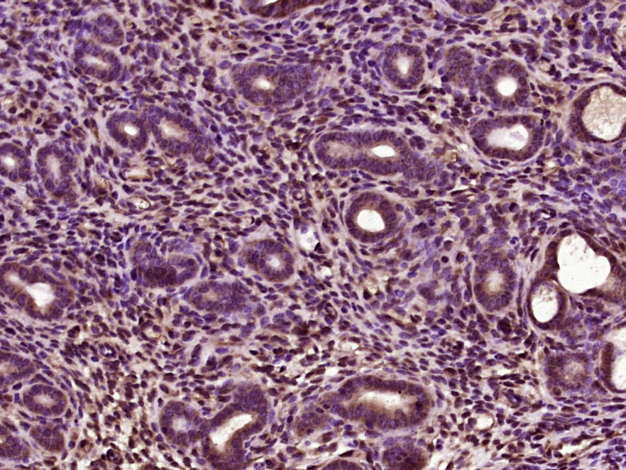 缺氧诱导因子1β/HIF-1β抗体-bs-1407R