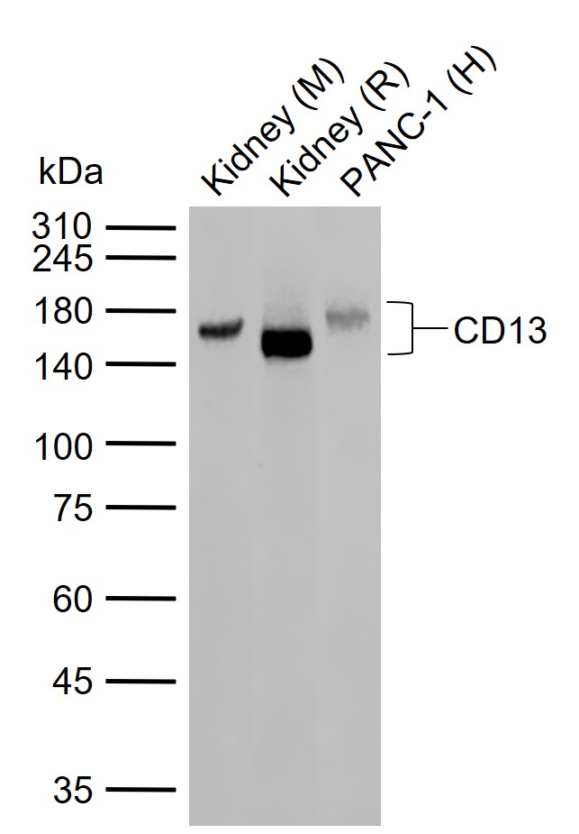 CD13重组兔单抗-bsm-60371R
