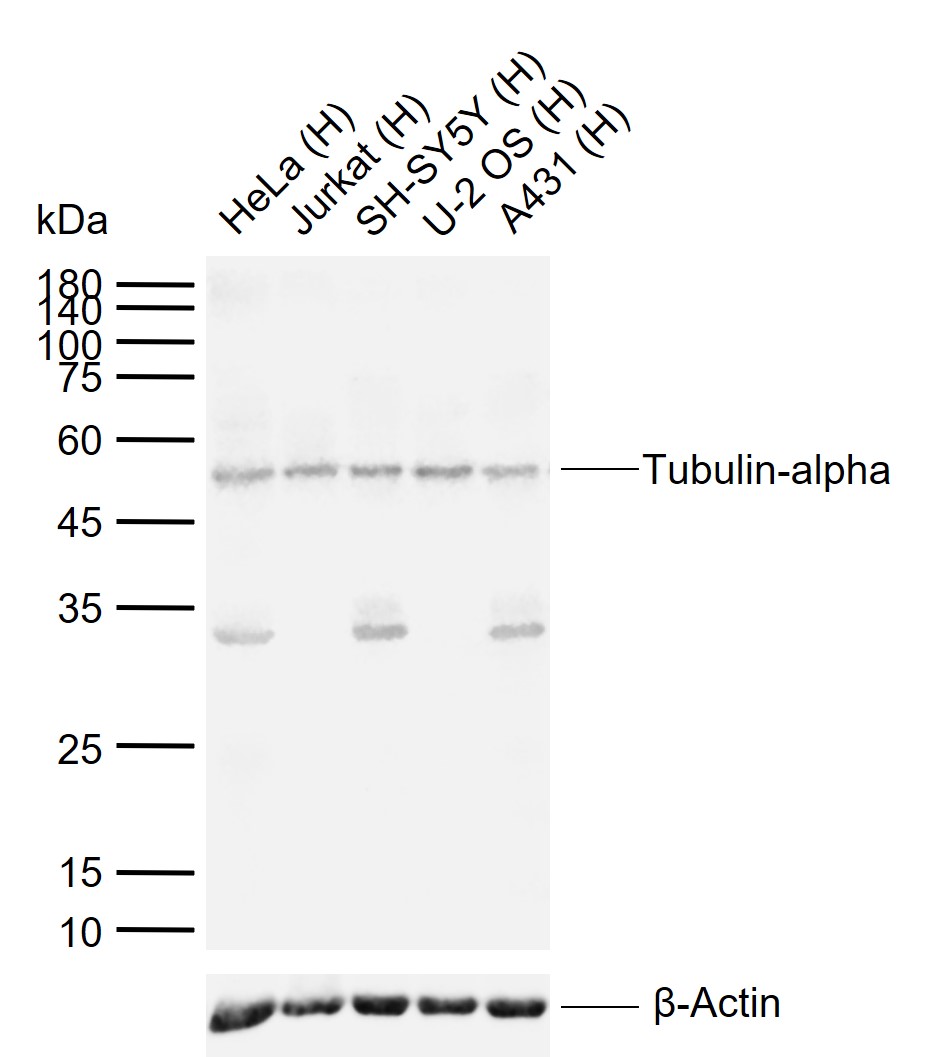 微管蛋白α/Tubulin α（内参）抗体-bs-0159R
