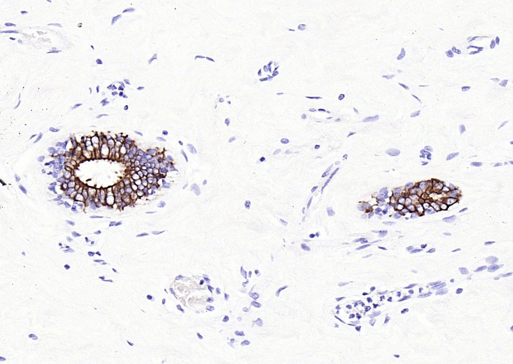 细胞角蛋白8重组兔单抗-bsm-52419R