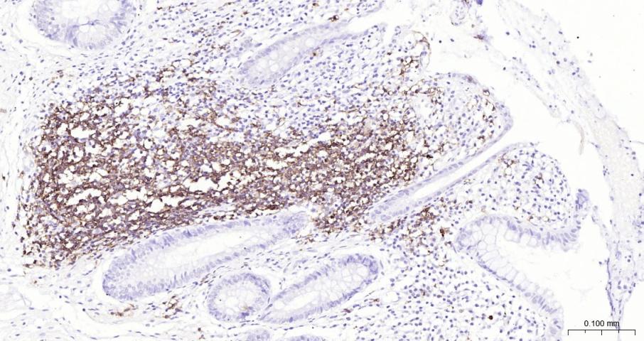 CD20重组兔单抗-bsm-60638R