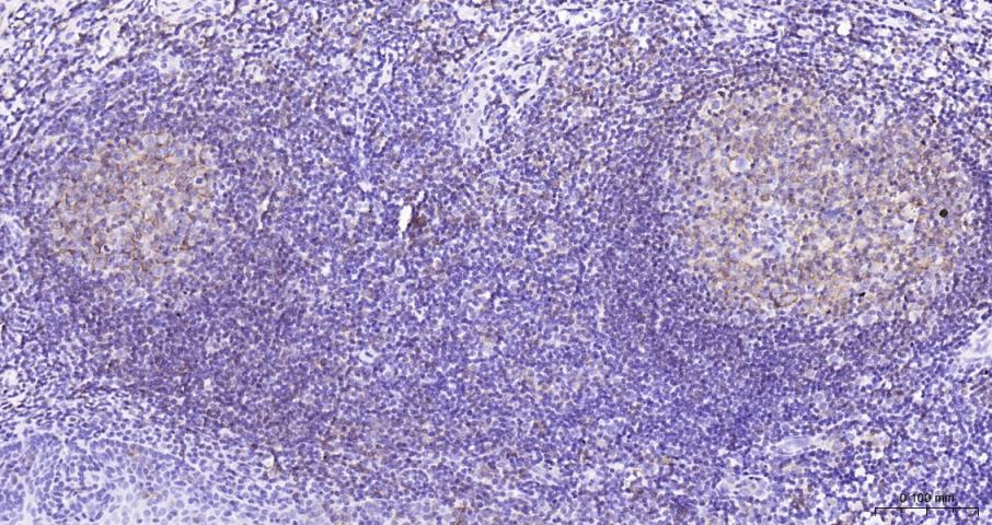 CD20重组兔单抗-bsm-60638R