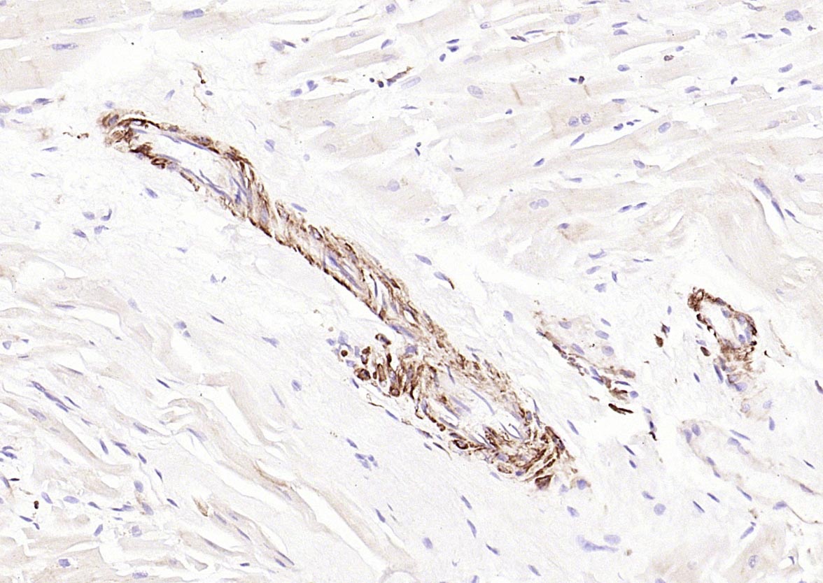 泛肌动蛋白重组兔单抗-bsm-60349R