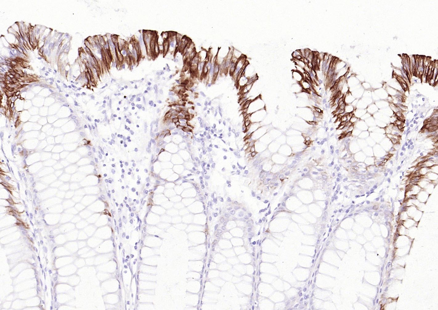 粘蛋白4重组兔单抗-bsm-60295R