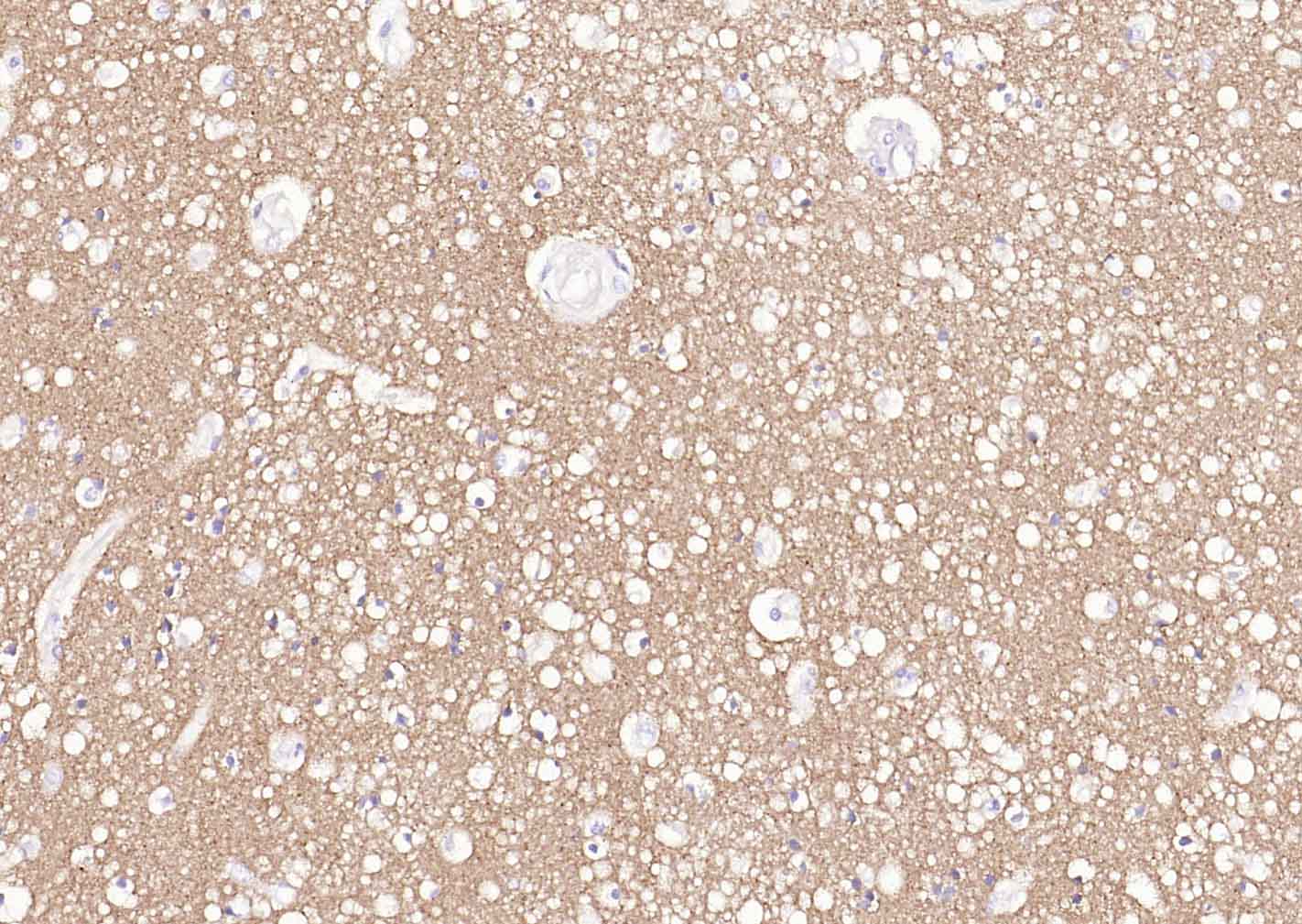 微管相关蛋白MAPT/Tau重组兔单抗-bsm-60835R