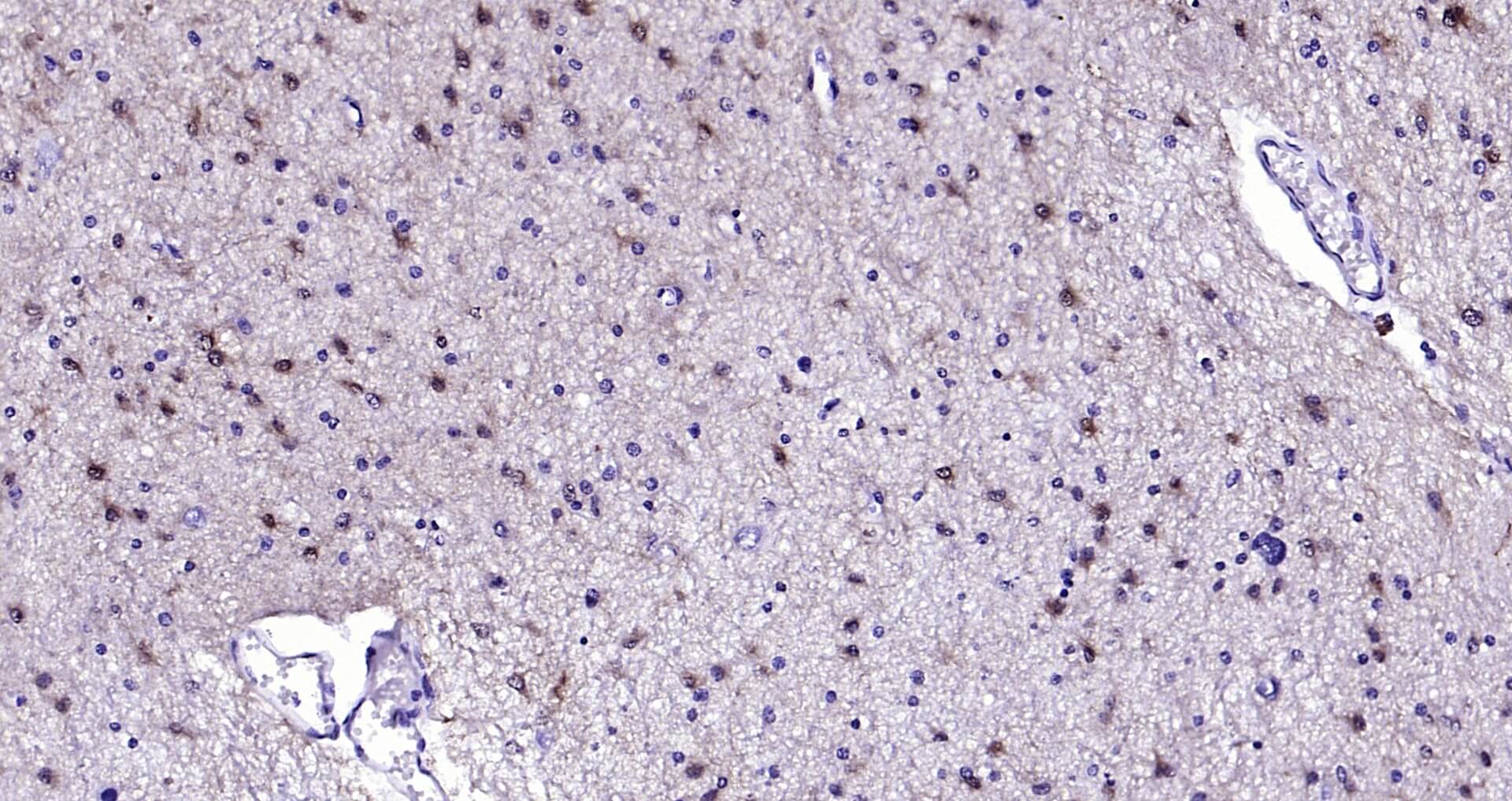蛋白单克隆即用型免疫组化试剂盒-IHC0110