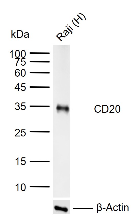CD20重组兔单抗-bsm-60638R