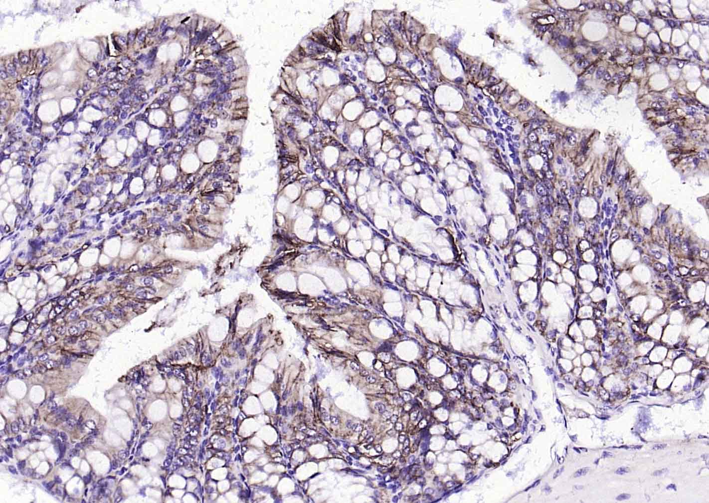 上皮细胞粘附分子（CD326）重组兔单抗-bsm-52417R