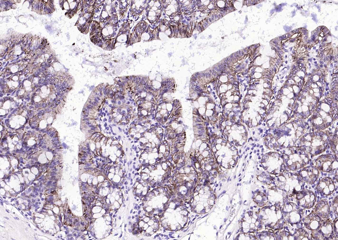 上皮细胞粘附分子（CD326）重组兔单抗-bsm-52417R