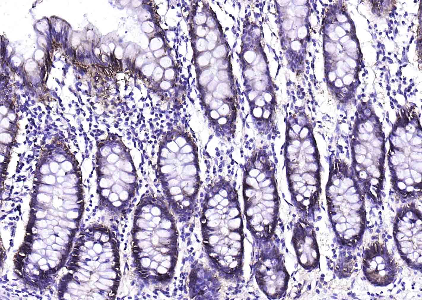 上皮细胞粘附分子（CD326）重组兔单抗-bsm-52417R