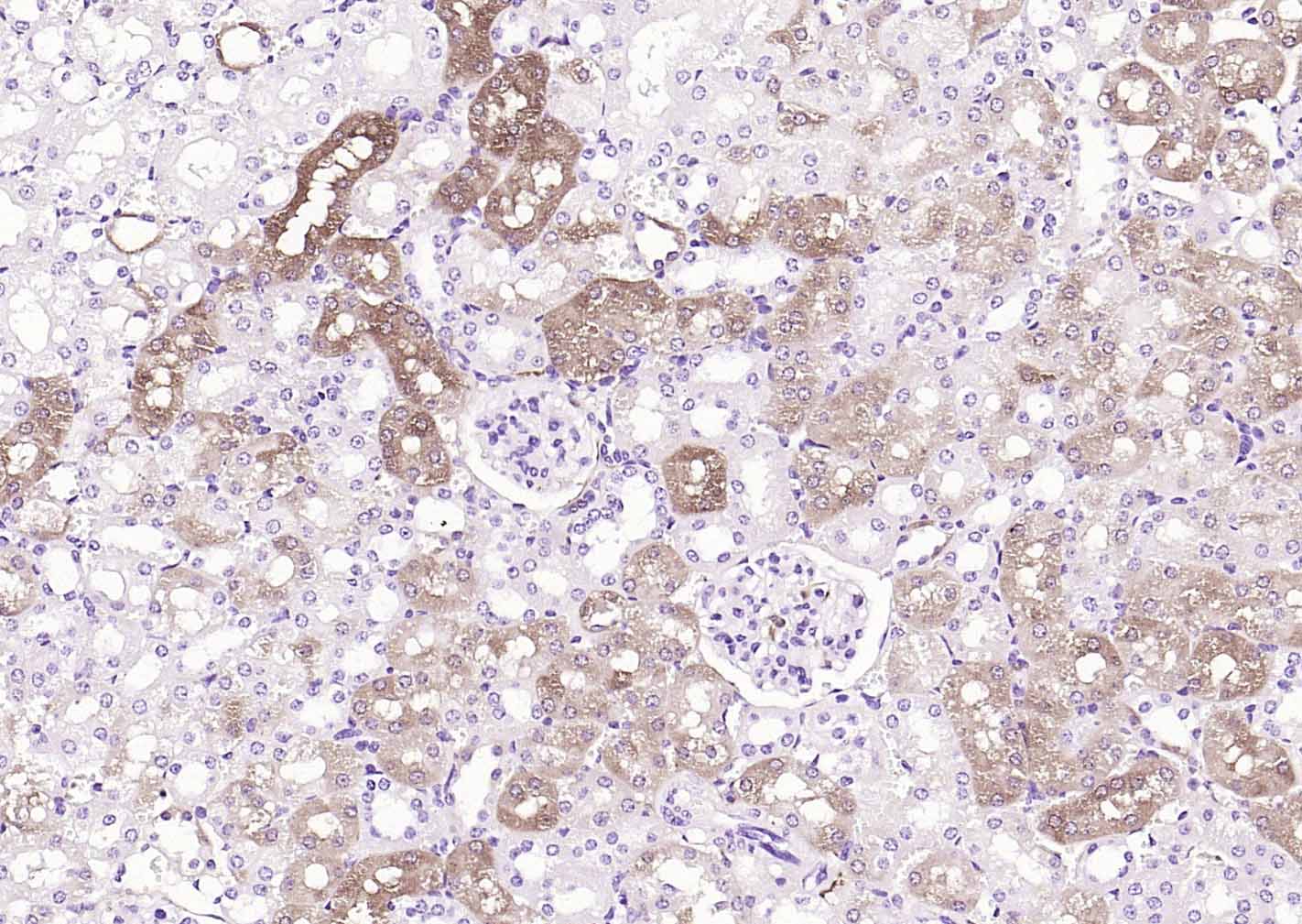 乙醛脱氢酶1型重组兔单抗-bsm-60321R