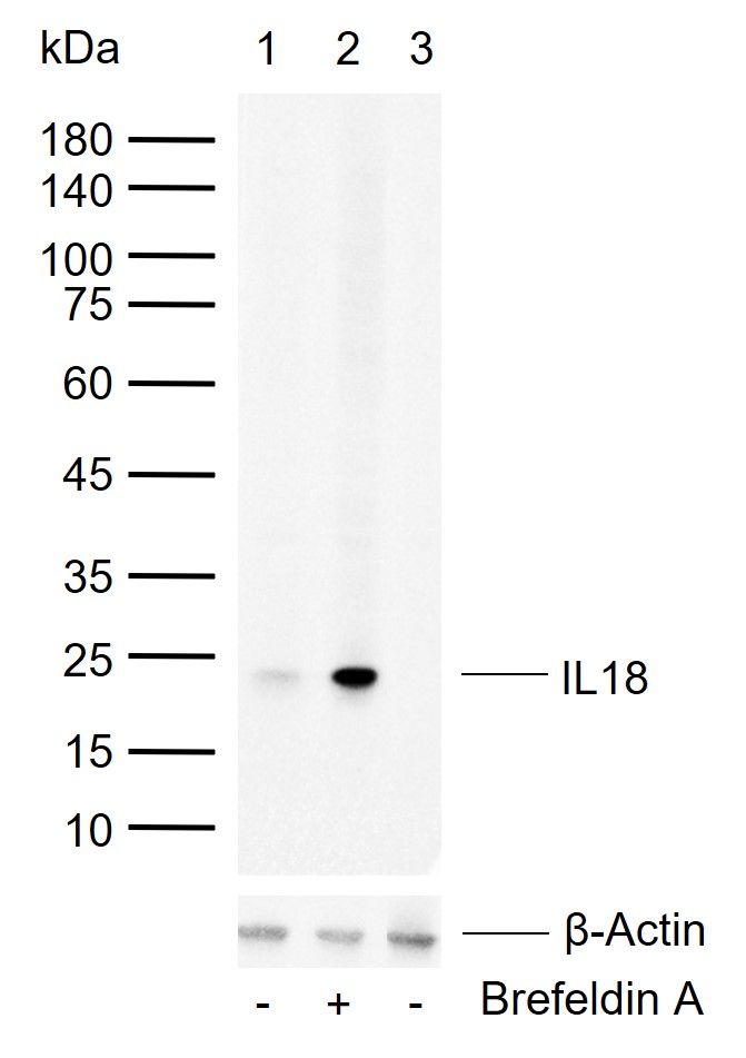 白细胞介素-18/干扰素γ诱导因子重组兔单抗-bsm-56205R