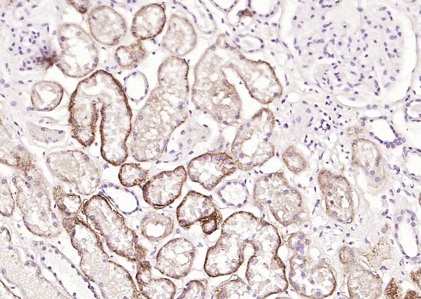 多配体蛋白聚糖1（CD138）重组兔单抗-bsm-60902R