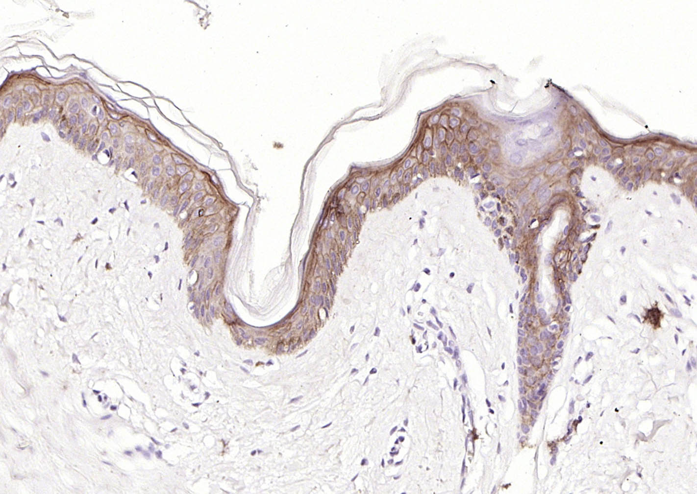 多配体蛋白聚糖1（CD138）重组兔单抗-bsm-60902R