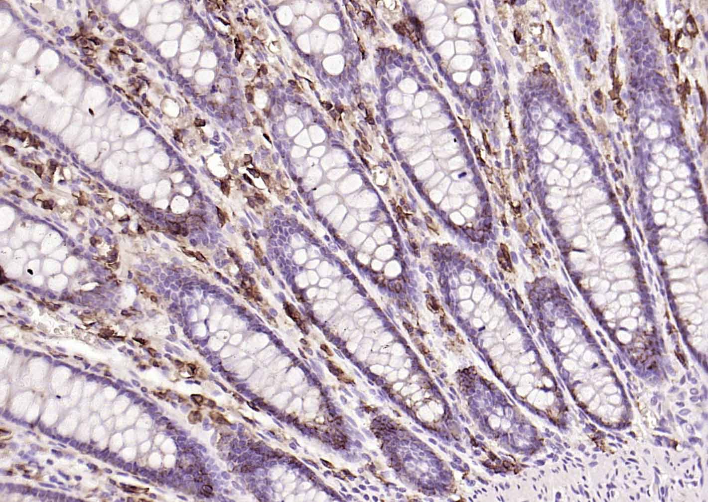 多配体蛋白聚糖1（CD138）重组兔单抗-bsm-60902R